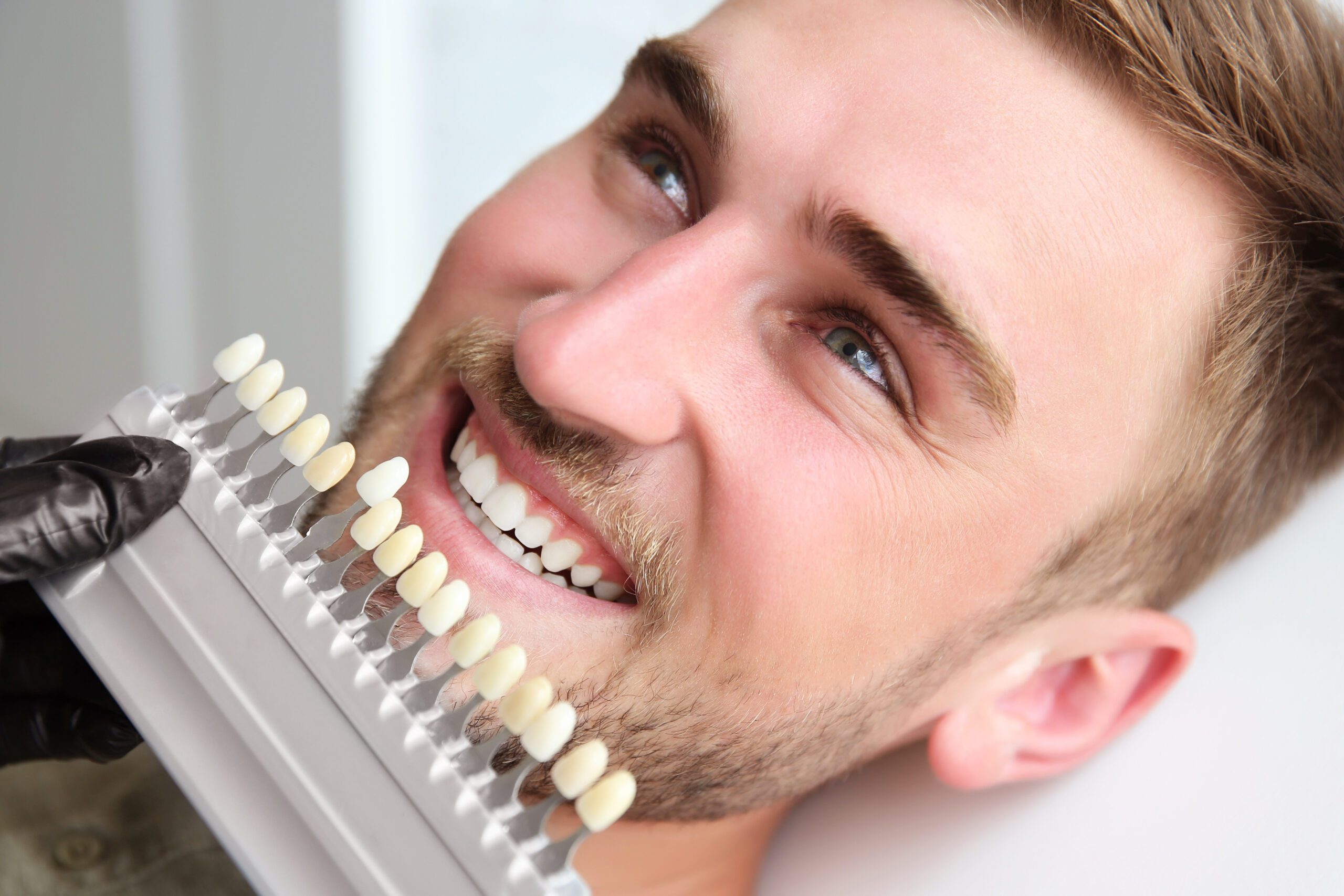 Young man choosing color of teeth at dentist